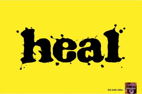 Get both sides.<br />Stem cells.